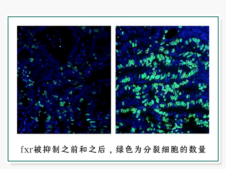 年轻人是怎么一步一步走向肠癌的？！