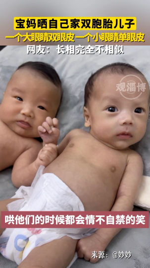 宝妈晒自己家双胞胎儿子，一个大眼睛双眼皮 一个小眼睛单眼皮