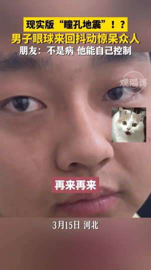 现实版“瞳孔地震”！？男子眼球可来回抖动，朋友：不是病，他自己能控制