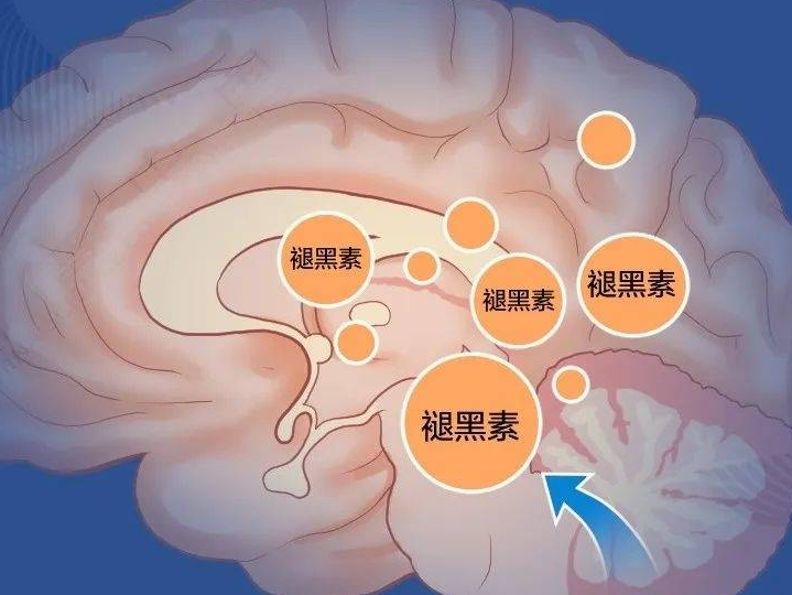 “喝杯牛奶好入睡”？真相可能没你想的那么简单