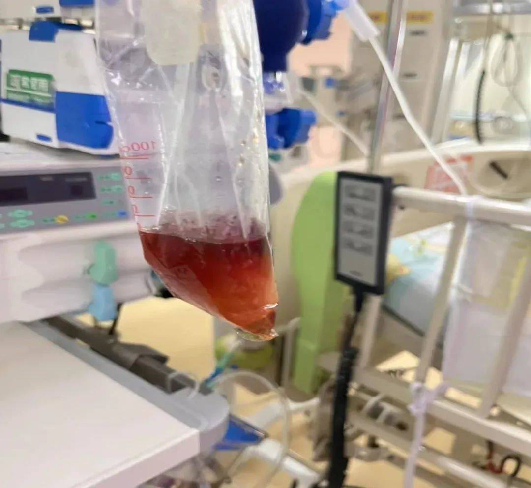 吃了一包零食，5岁男孩进了ICU！警惕这种病！