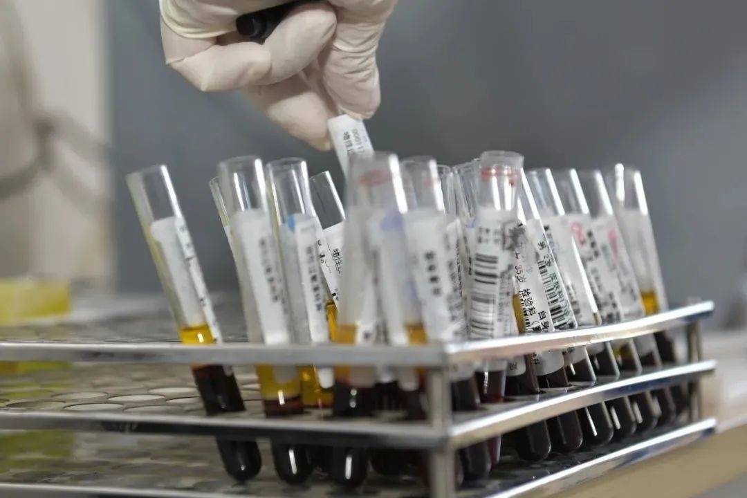 不痛不痒，很多人发现就是晚期！这三个征兆一定要重视