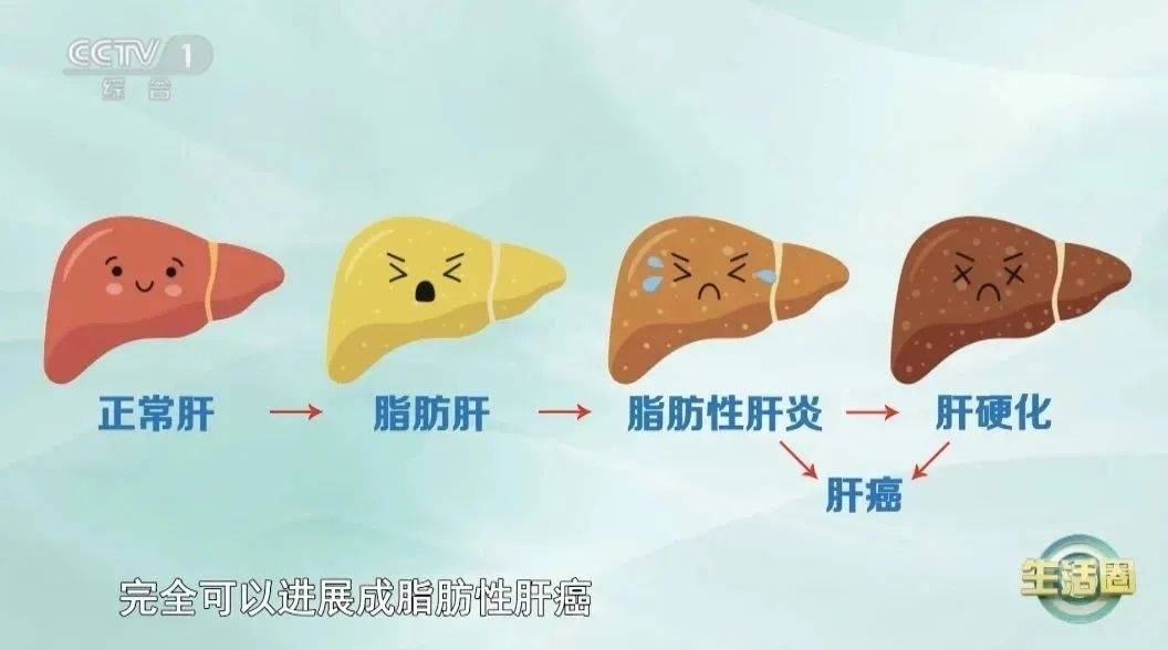 45岁前有这个特征，多年后更易得癌？现在改还来得及&rarr;