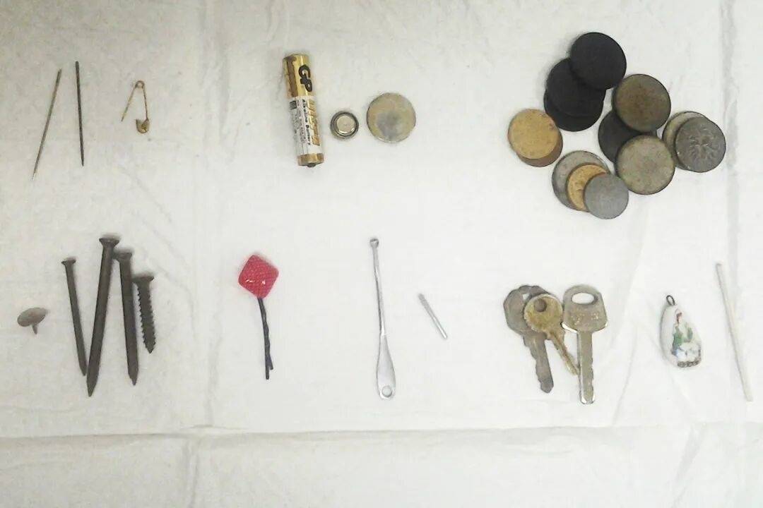 一幼儿食道被腐蚀！家里这种&ldquo;小圆片&rdquo;千万要收好