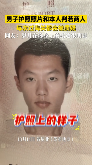 男子护照照片和本人判若两人 每次过海关都会被质疑