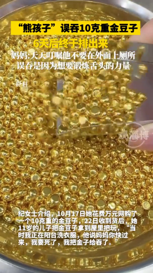 &ldquo;熊孩子&rdquo;误吞10克重金豆子，6天后终于排出来