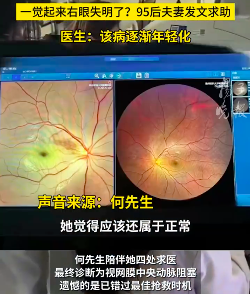 不疼不痒，突然失明！降温小心&ldquo;眼中风&rdquo;&rarr;