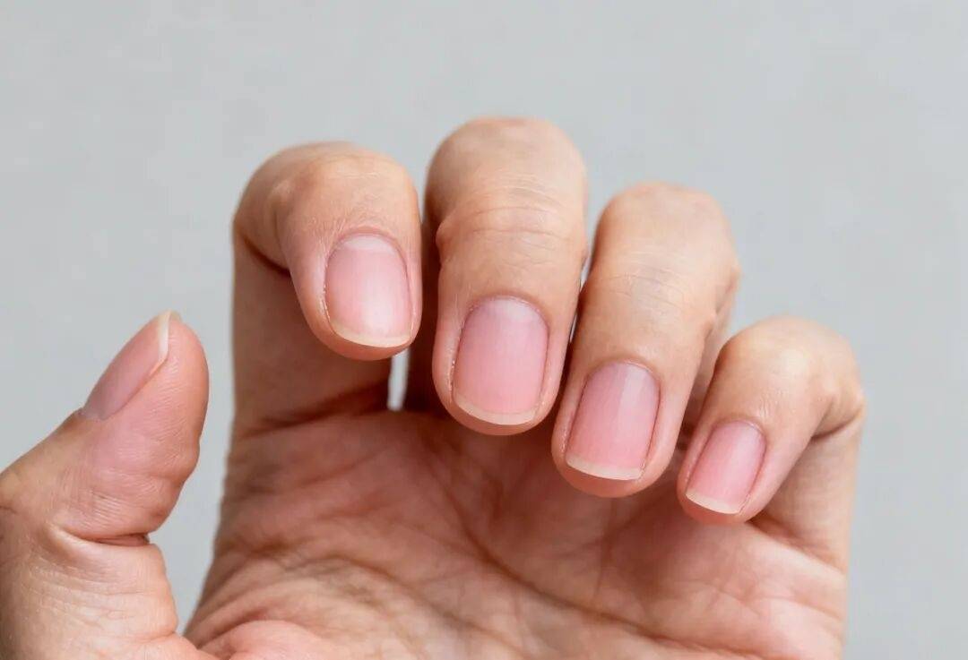 指甲上月牙少=不健康？