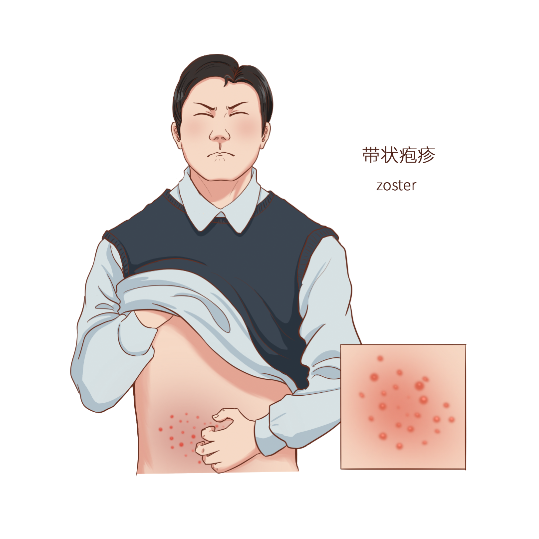 千库网_常见医疗人物疾病图例带状疱疹_元素编号14589910.png